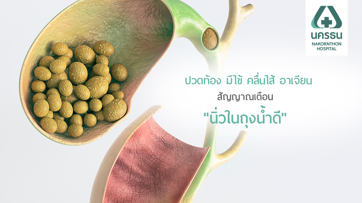 นิ่วในถุงน้ำดี อันตรายที่ไม่ควรมองข้าม